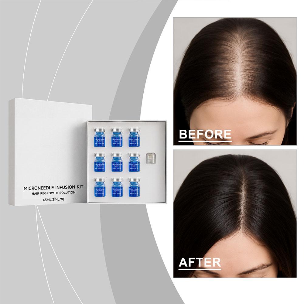 Hair Care Oil Serum - 0.25mm Hair Essential Serum Micro-needle Roller