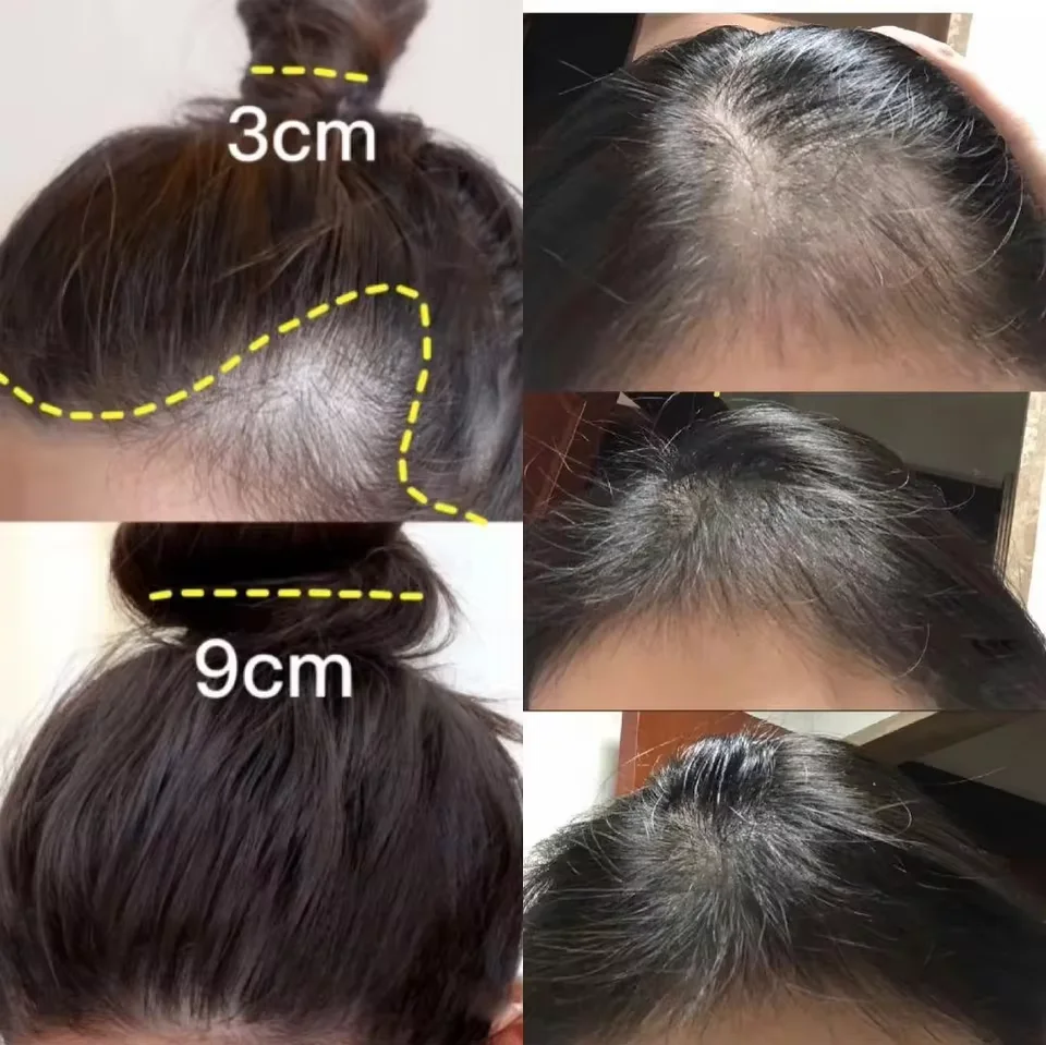 Fast Ginger Hair Growth Cream  - Hair Care Dupes review and price